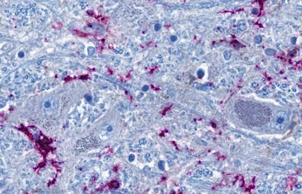 Angefärbter Gewebeschnitt, mit runden und fadenförmigen graublauen Strukturen, durchsetzt mit lilafarbenen Bereichen.