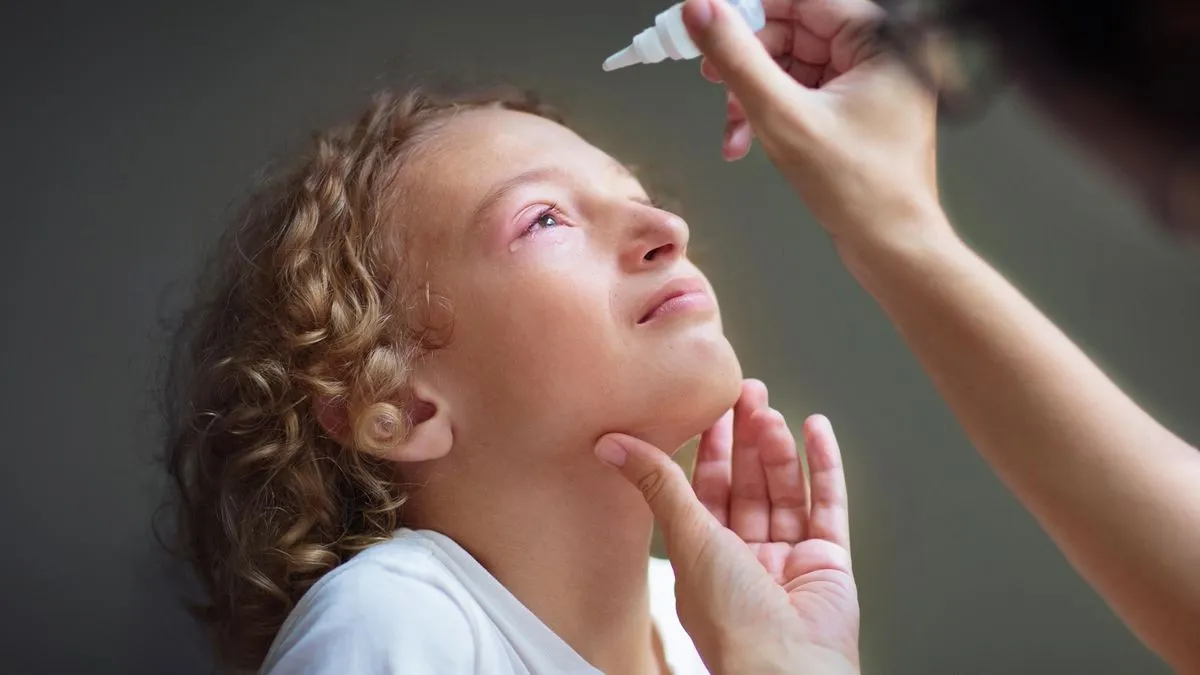 Bindehautentzündungen treten bei Kindern häufiger im Zusammenhang mit bestimmten Corona-Varianten auf.