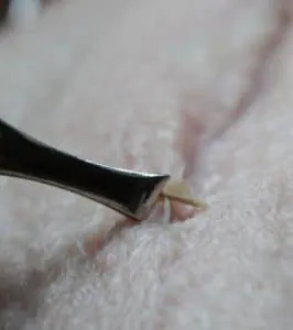 Entfernen von Federkielen und überschüssigem Fett von der rohen Gänsebrust