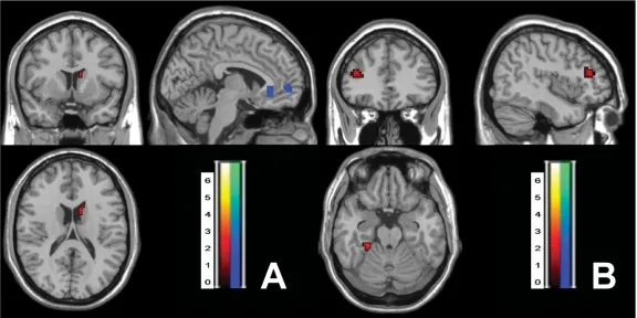 graphic file with name 4FF3.jpg