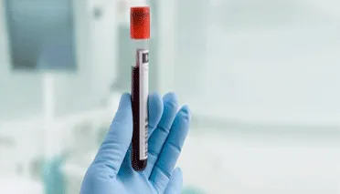 Informative Grafik zeigt die Bedeutung von LDL-C, HDL-C und Triglyceriden für die Cholesterinwerte