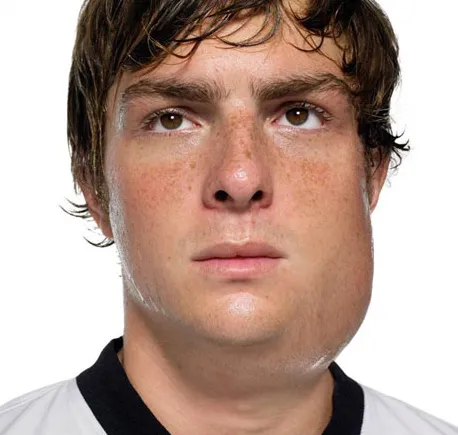 Jeune homme avec une grosse enflure sous l