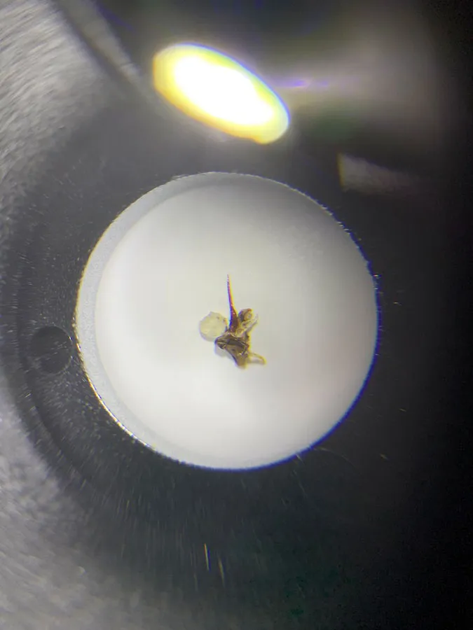 Detaillierte Darstellung eines Bienenstachels mit der anhängenden Giftblase, um die Funktion zu verdeutlichen