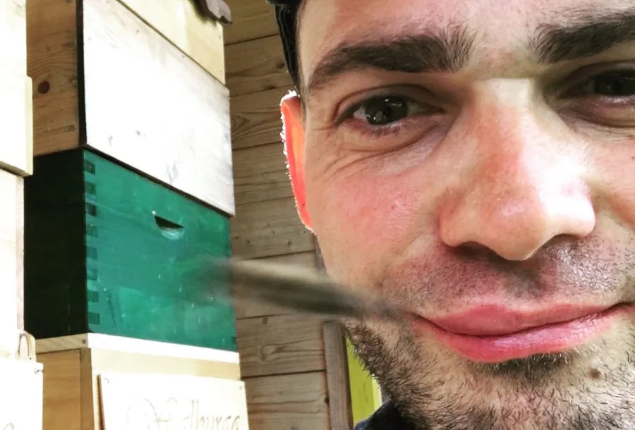 Nahaufnahme eines Bienenstichs an der Lippe, die angeschwollen ist, als Beispiel für eine Schwellung