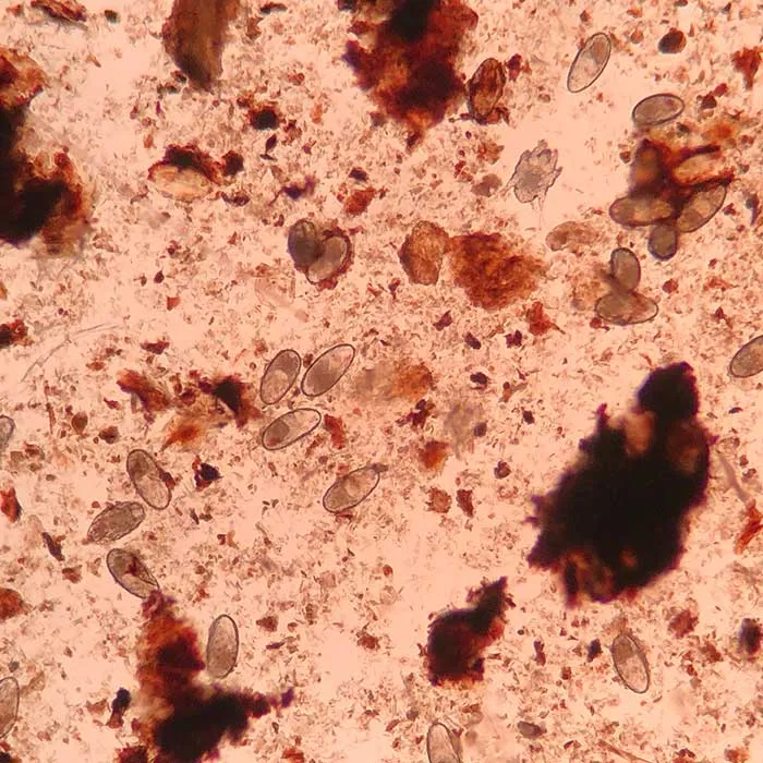 Ohrmilben unter dem Mikroskop.