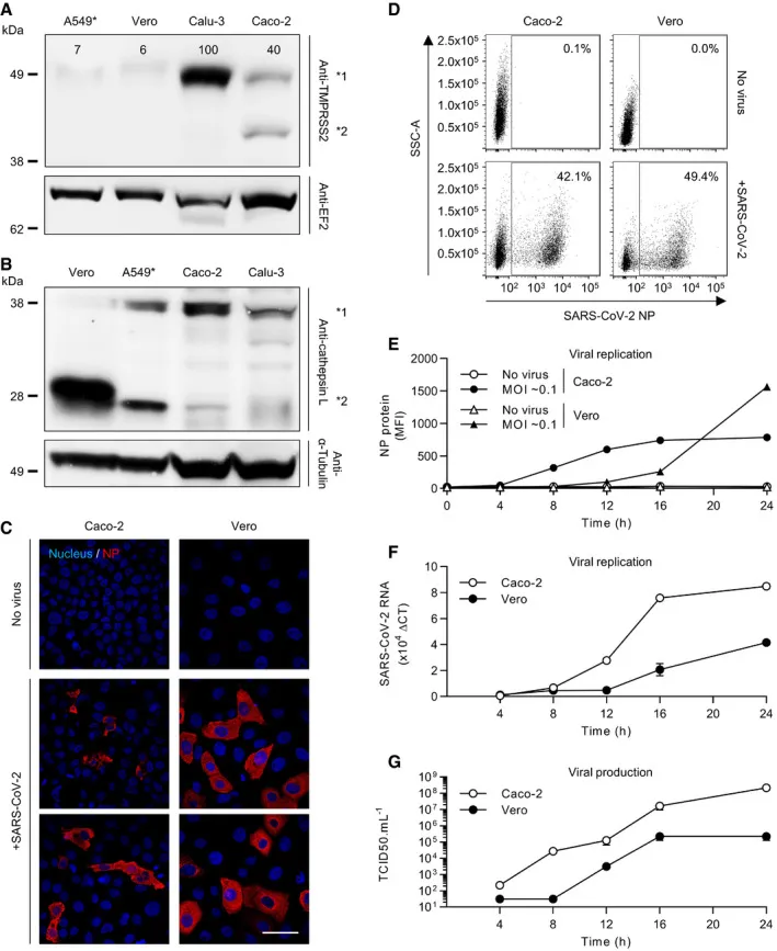 Quantifizierung der SARS-CoV-2-Infektion in Calu-3, Caco-2, A549 und Vero-Zellen